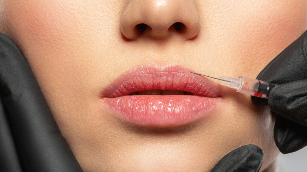 Aumento y perfilado de labios en el centro de Valencia
