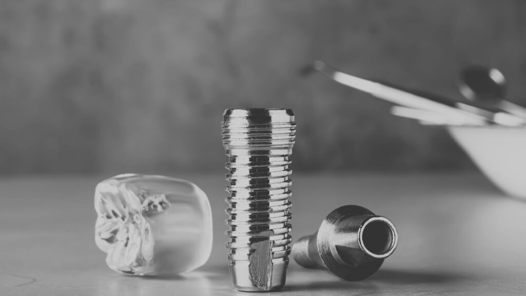 La mejor clínica de implantes en Valencia